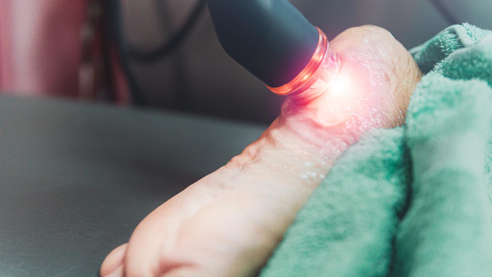 Shockwave therapy treatment